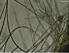 Immagine di una cellula marina vista attraverso i microscopio elettronico
