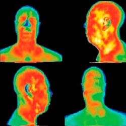 Accertamento della temperatura del corpo umano con le camere termografiche.