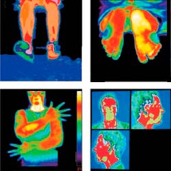 Accertamento della temperatura del corpo umano con le camere termografiche.