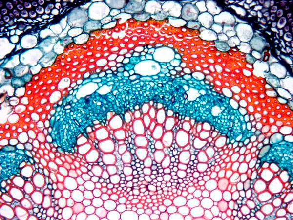 Nell'immagine superiore pu� osservarsi una cellula che � stato tratta con tingitura per suo osservazione migliore attraverso i microscopi.